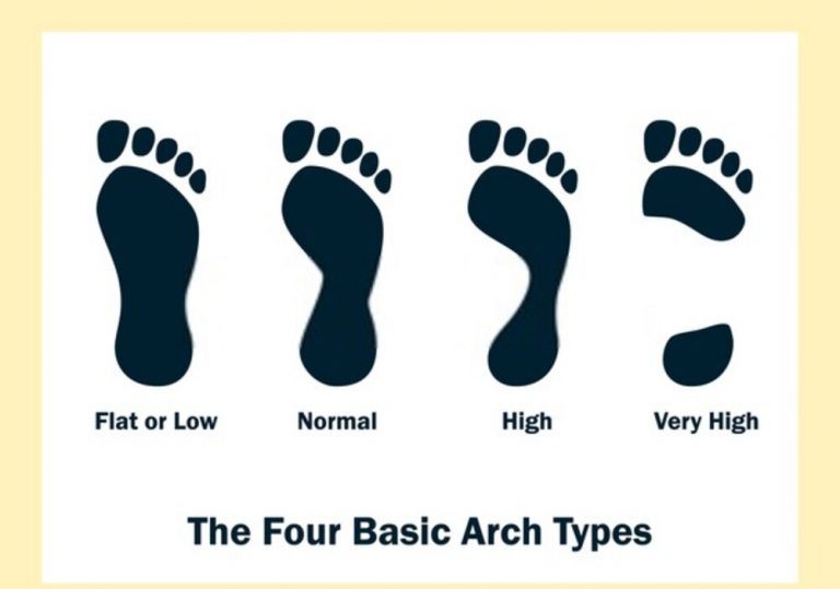 the-importance-of-arch-support-livestrong-com