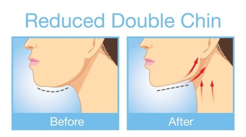 How to Get Rid of Double Chin: Causes and Simple Exercises - Hood MWR