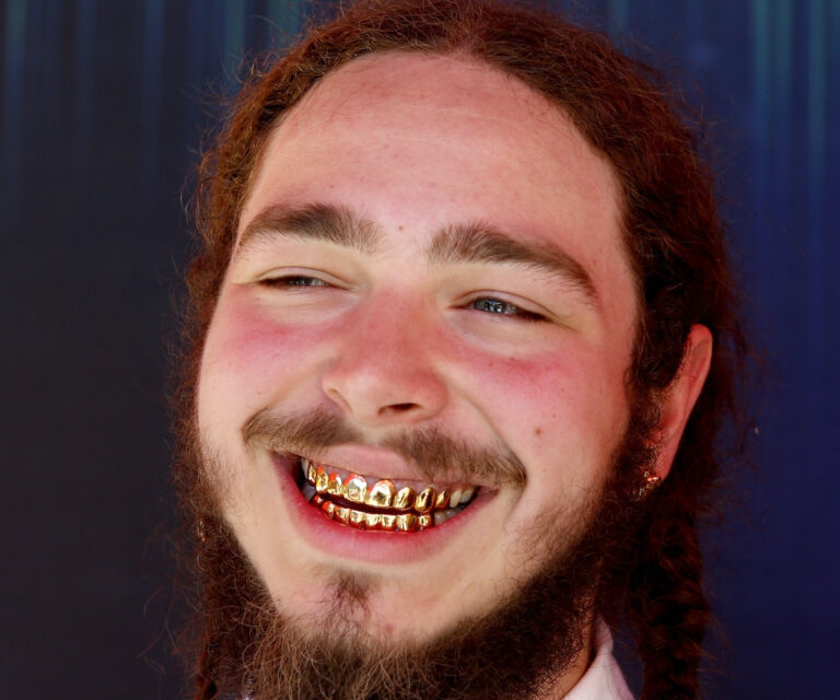 50 Famous People Decorate Their Teeth With Gems Hood MWR   40. Post Malone 768x640 